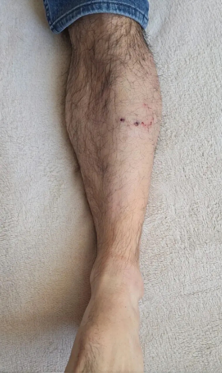 ❗️На одном из волжских предприятий стая собак искусала человека