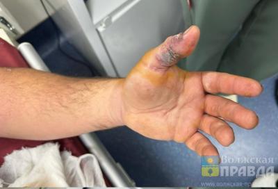 В Волгоградской области 16 человек пострадали от укусов змей