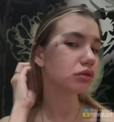 Головой, кулаком и лбом: обидчик волжанки, не давшей себя «потрогать», заявил, что она била его сама